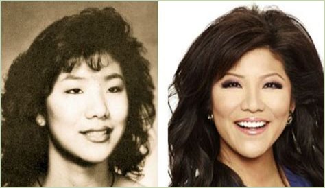 Did the Big Brother Host Undergo Procedures Other Than Double Eyelid Surgery?